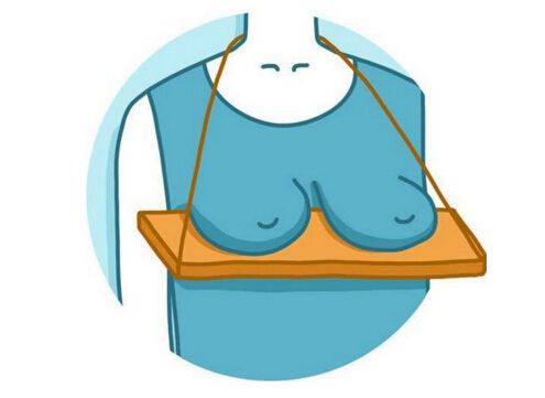 乳房下垂是哪些原因导致的？