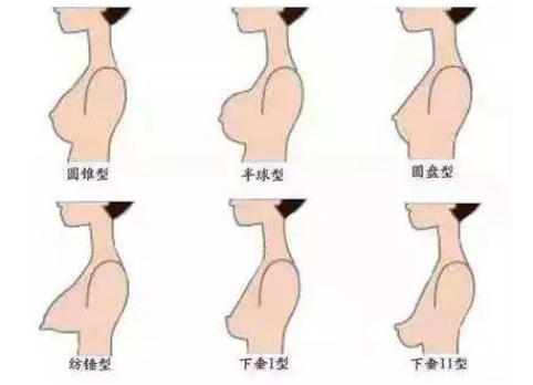 预防乳房下垂，坚挺你的地心引力