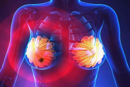 中国乳腺癌发病率居高不下，预测2021年患者将高达250万！